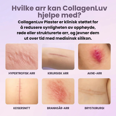 CollagenLuv™ Kollagen Silikonplaster