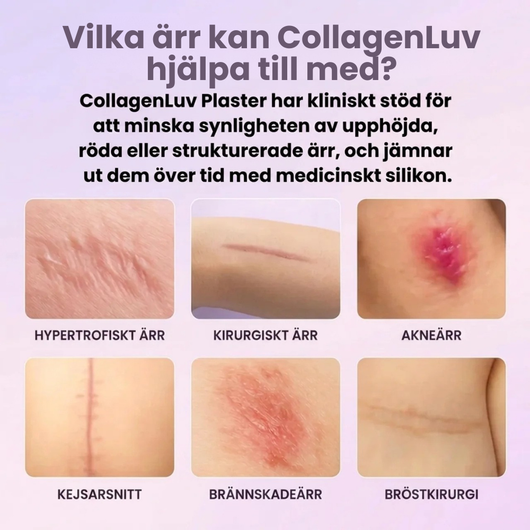 CollagenLuv™ Kollagen Silikone Plaster