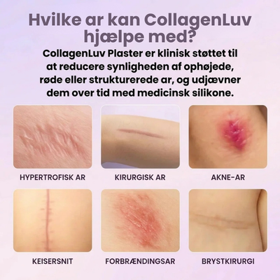 CollagenLuv™ Kollagen Silikoneplaster