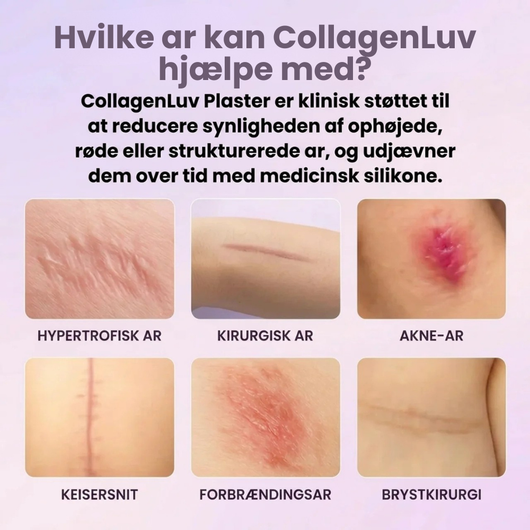 CollagenLuv™ Kollagen Silikoneplaster