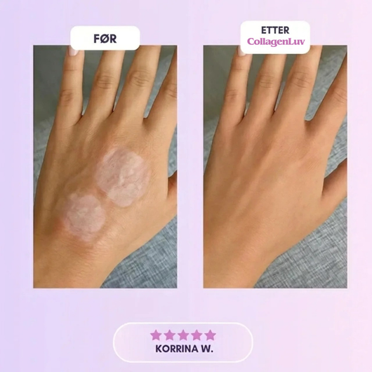 CollagenLuv™ Kollagen Silikonplaster