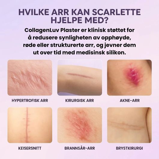 CollagenLuv™ Kollagen Silikonplaster