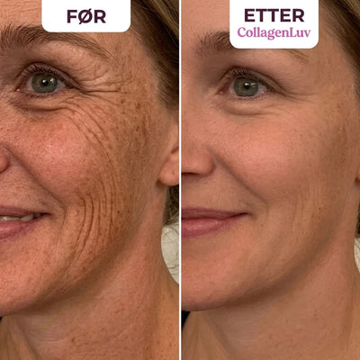 CollagenLuv™ Kollagen Silikonplaster