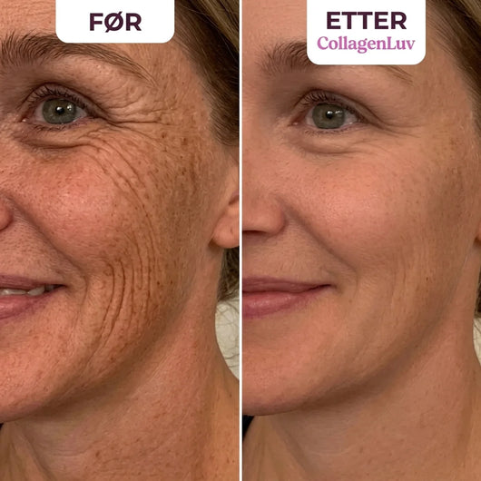 CollagenLuv™ Kollagen Silikonplaster