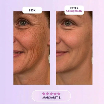CollagenLuv™ Kollagen Silikoneplaster