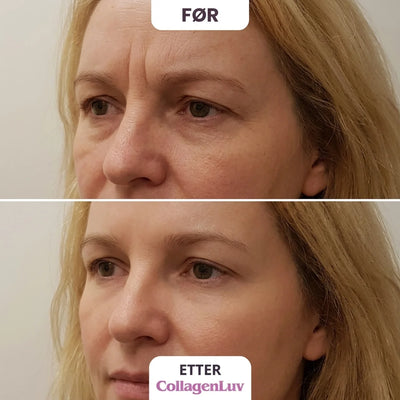 CollagenLuv™ Kollagen Silikonplaster