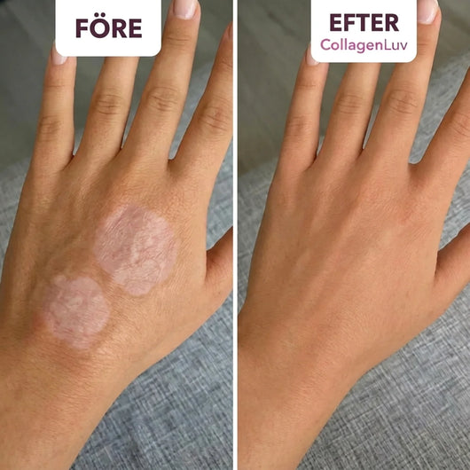 CollagenLuv™ Kollagen Silikone Plaster