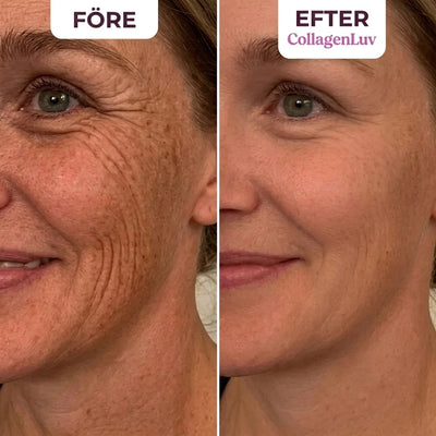 CollagenLuv™ Kollagen Silikone Plaster