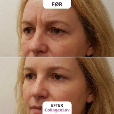 CollagenLuv™ Kollagen Silikoneplaster