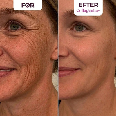 CollagenLuv™ Kollagen Silikoneplaster