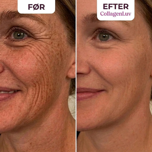CollagenLuv™ Kollagen Silikoneplaster